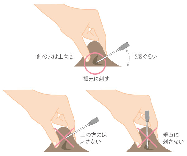 猫の肩甲骨下あたりの皮膚をつまみテントを張るようにする